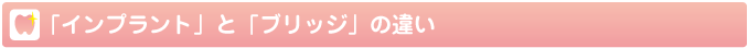 「インプラント」と「ブリッジ」の違い